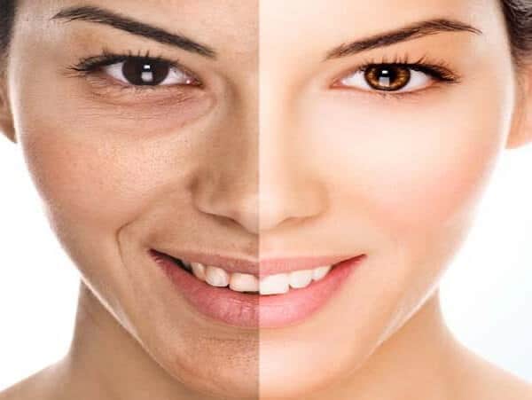 Îmbătrânirea pielii: tot ce trebuie să știi
