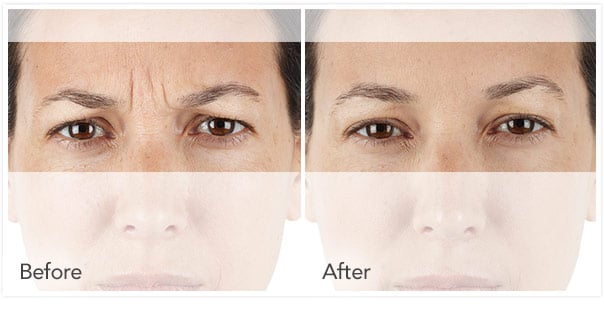 recenzii pentru îngrijirea pielii faciale anti-îmbătrânire